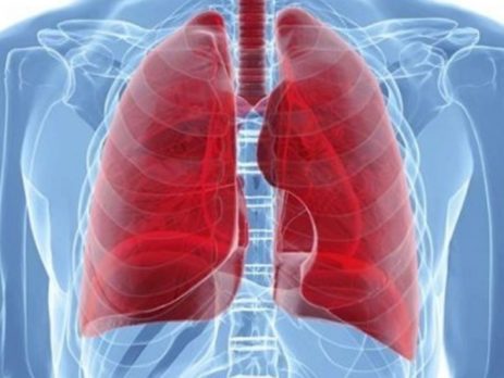 Туберкульоз