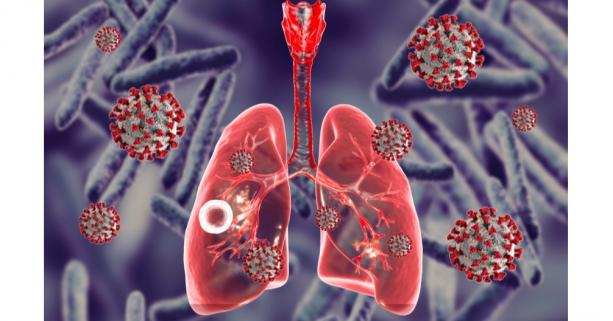 Туберкульоз (ТБ)